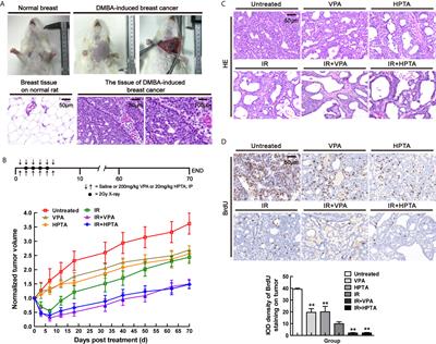 Valproic Acid-Like Compounds Enhance and Prolong the Radiotherapy Effect on Breast Cancer by Activating and Maintaining Anti-Tumor Immune Function